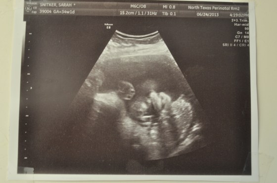 nose, chin and a hand